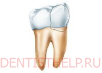 Вывих и перелом зуба