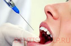 анестезия при лечении каналов зуба