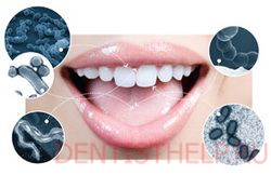 дисбаланс микрофлоры полости рта