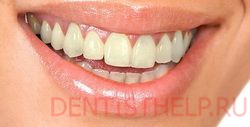 незначительные темные пятна на зубах показания к домашнему отбеливанию зубов