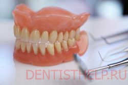 наличие зубных протезов - противопоказание для домашнего отбеливания зубов