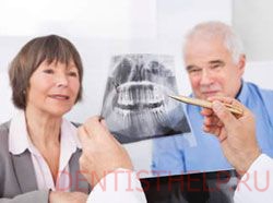 рентген зубов - один из этапов подготовки к имплантации