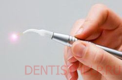 лечение зубов лазером