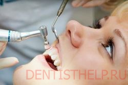 этапы реставрационного отбеливания зубов