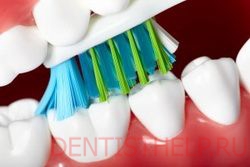 правильная зубная щетка - защита от воспаления десен