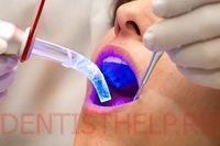 Современные зубные пломбы - световая пломба