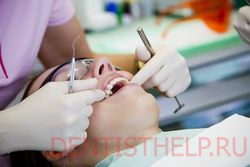 витальный метод удаления нерва зуба