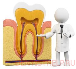методы удаления зубного нерва