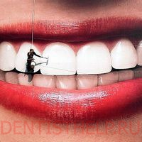 внутриканальное отбеливание зубов