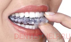 каппы при бруксизме