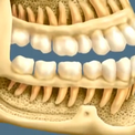 Виды зубных заболеваний