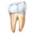 Вывих и перелом зуба
